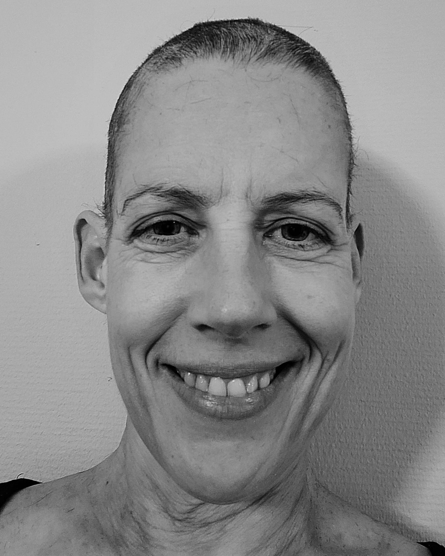 Door de chemo viel haar haar uit, dus besloot ze het af te scheren. Foto: Petra Feddema