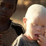 Tussen licht en duisternis; de gevaren en realiteit van albino’s in Afrika