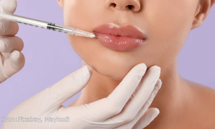 FactcheckVan gratis botox tot strenge regels: zo zit het echt