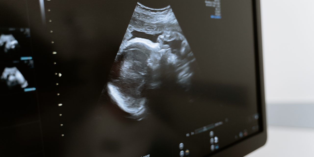 Abortus plegen in de kliniek: Een cultuur die bijna niemand kent