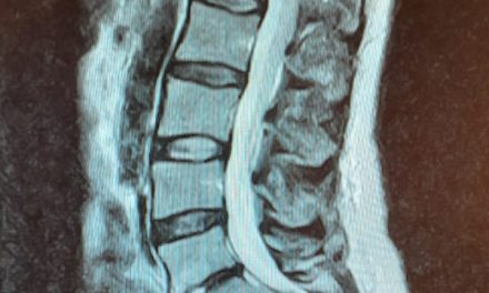 “Je lijf laat je in de steek” De tol van werken in de zorg