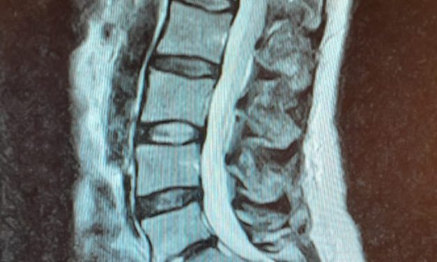 “Je lijf laat je in de steek” De tol van werken in de zorg