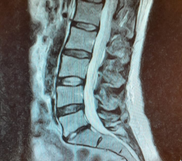 “Je lijf laat je in de steek” De tol van werken in de zorg
