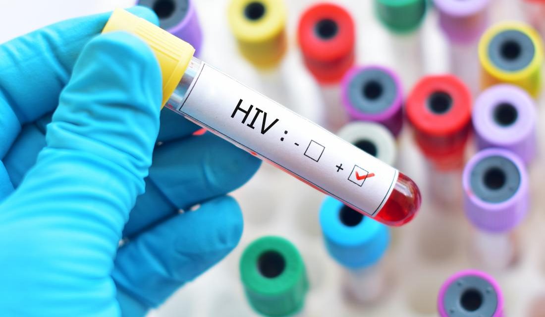 Aandeel hiv diagnoses onder jonge mannen stijgt