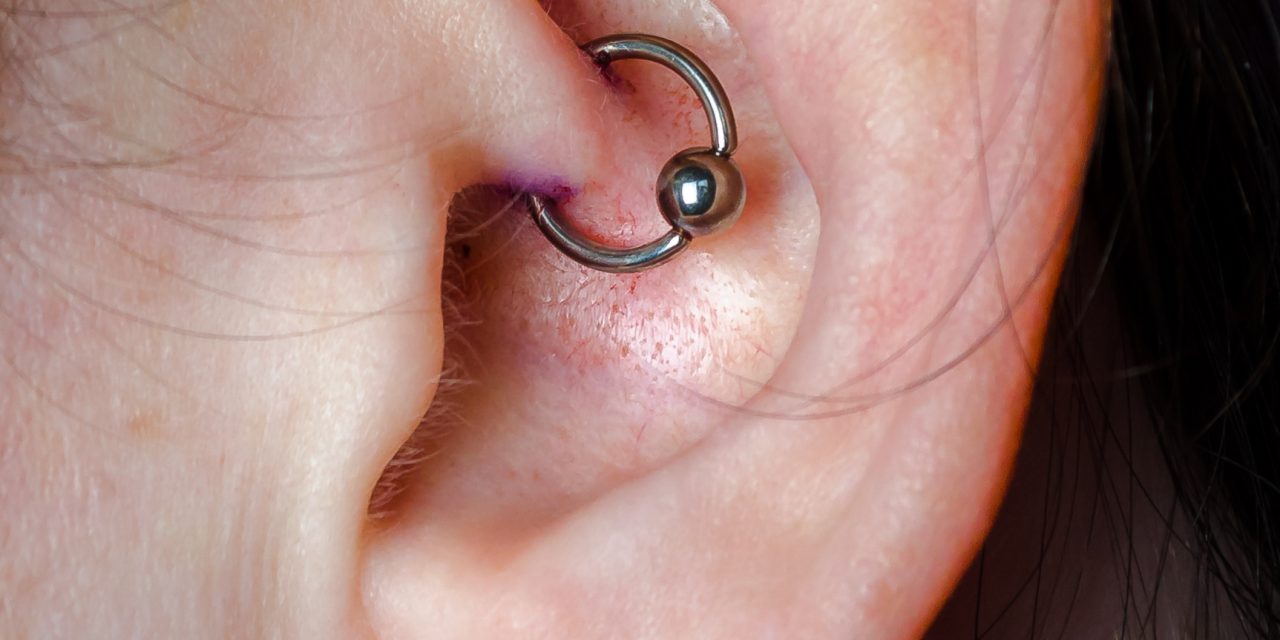 Factcheck: helpt een daithpiercing tegen migraine?