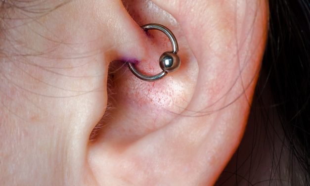 Factcheck: helpt een daithpiercing tegen migraine?