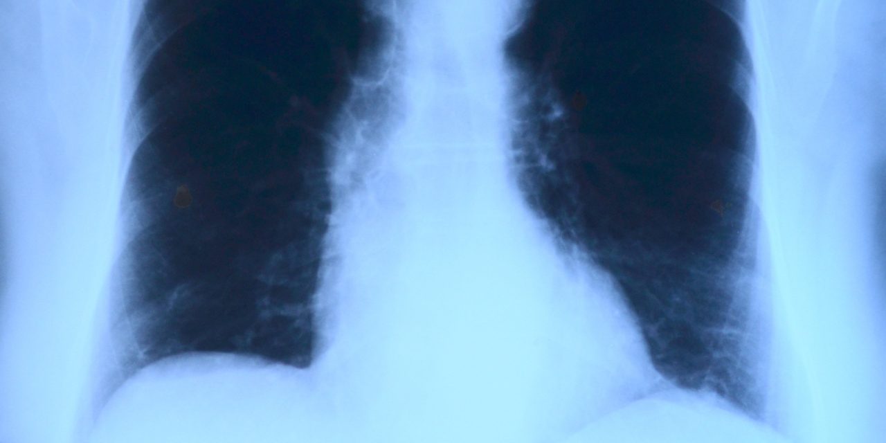 Factcheck: Zien longartsen bijna dagelijks zieke kinderen door schimmelwoningen?