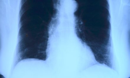 Factcheck: Zien longartsen bijna dagelijks zieke kinderen door schimmelwoningen?