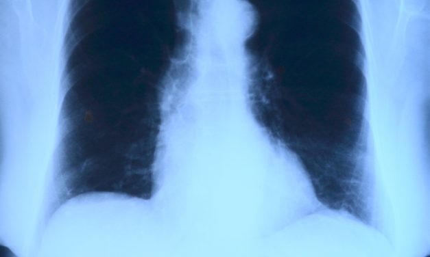 Factcheck: Zien longartsen bijna dagelijks zieke kinderen door schimmelwoningen?